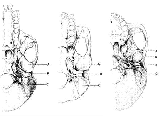 Dentición